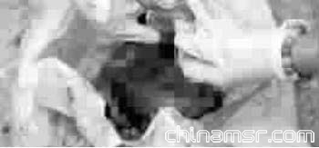 妇产科医生称，还不能确定这胎盘是人的还是动物的