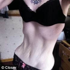 严重的营养不良让丽贝卡骨瘦如柴，面临多种疾病威胁