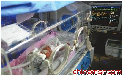 产妇过胖引起多脏器功能不全