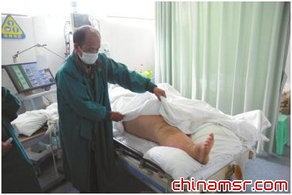 产妇过胖引起多脏器功能不全