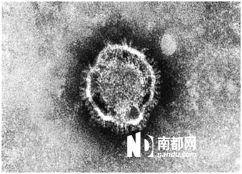 类SARS病毒来袭全球18人死亡