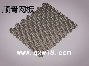 钛网颅骨网板连接片