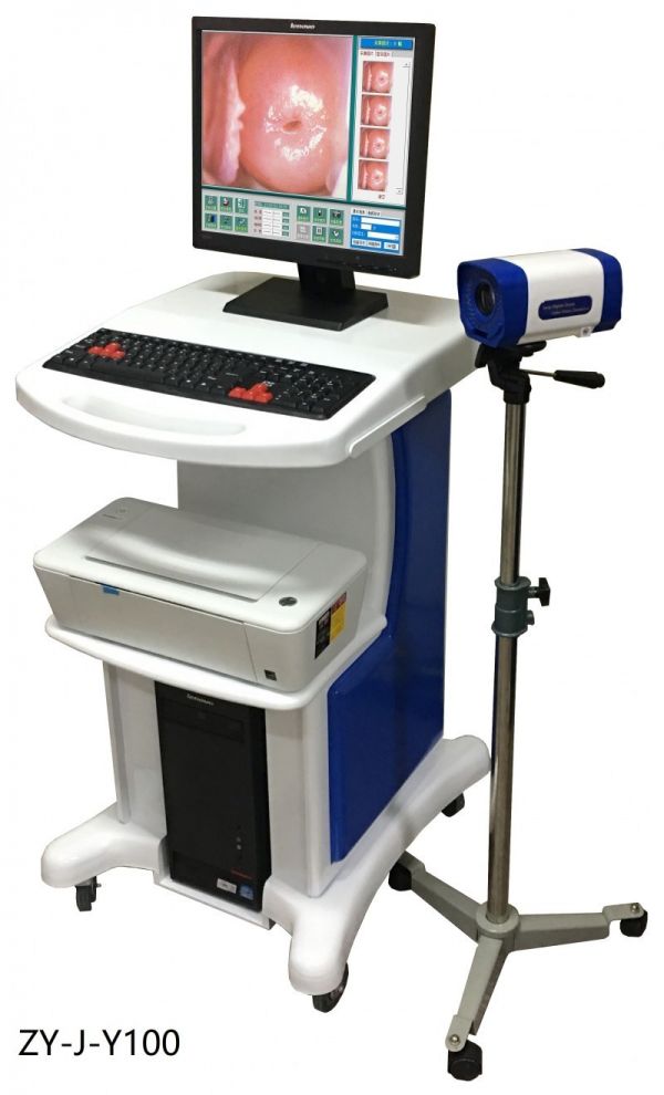 数码电子阴道镜