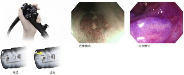 奥林巴斯高端电子胃肠镜CV-290