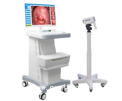 经典标清电子阴道镜