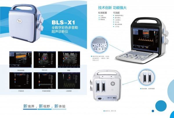 全数字彩色多普勒超声诊断仪