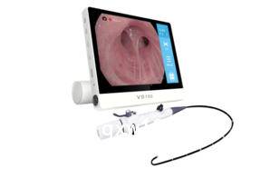 电子软镜可视喉镜