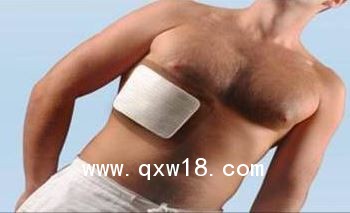 九毓维 胸骨固定板