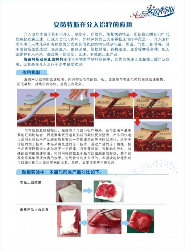 安茵特斯动脉止血材料