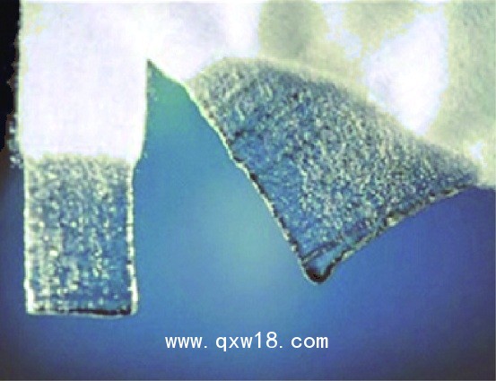 艾吉康藻酸盐敷料