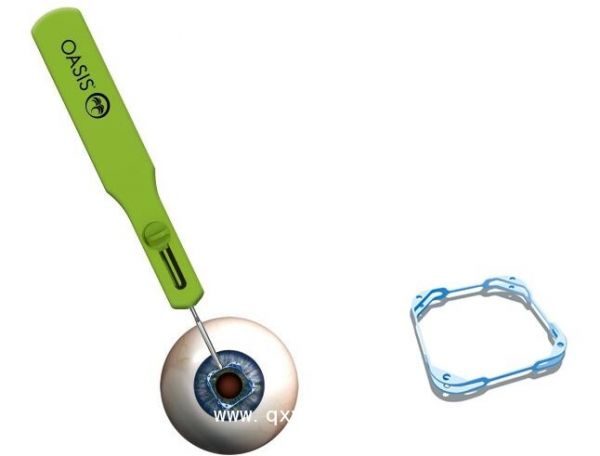 预装式虹膜扩张器