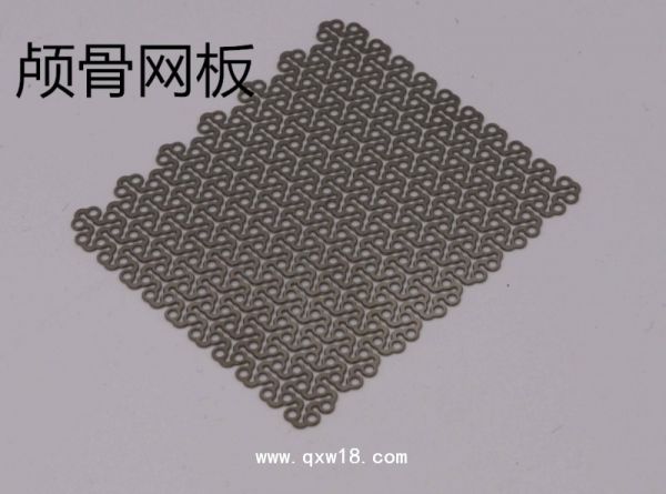 神经外科脑外科钛网颅骨网板