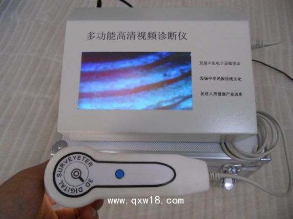 气血检测仪一体机