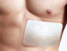 肋骨记忆合金夹板