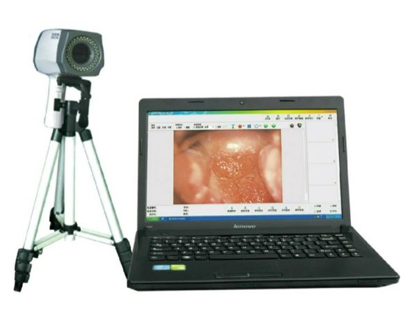 数码电子阴道镜