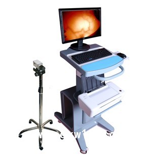 红外乳腺检测仪