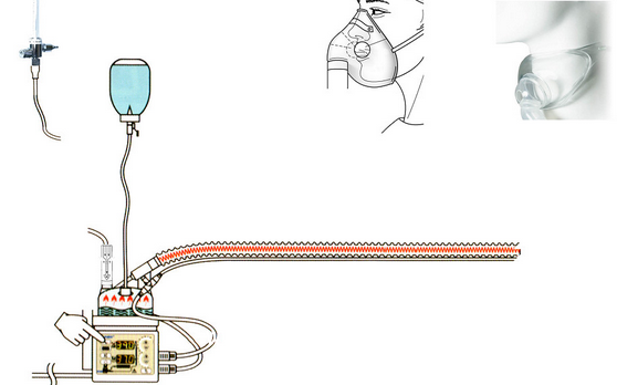 氧疗湿化治疗系统