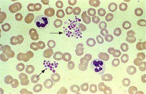 5轻度红细胞聚集