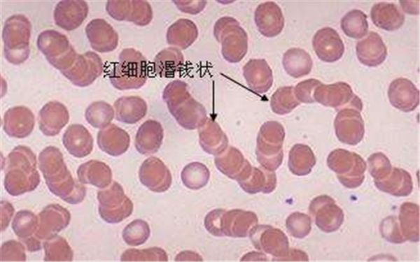 6中度红细胞聚集