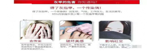 lALPDefRxQHhgtLM4c0ChA_644_225